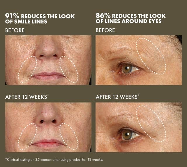 91% REDUCES THE LOOK OF SMILE LINES | BEFORE | AFTER 12 WEEKS* | 86% REDUCES THE LOOK OF LINES AROUND EYES | BEFORE | AFTER 12 WEEKS* | *Clinical testing on 35 women after using product for 12 weeks.