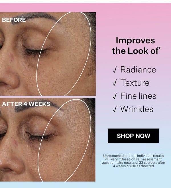 Improves the look of radiance