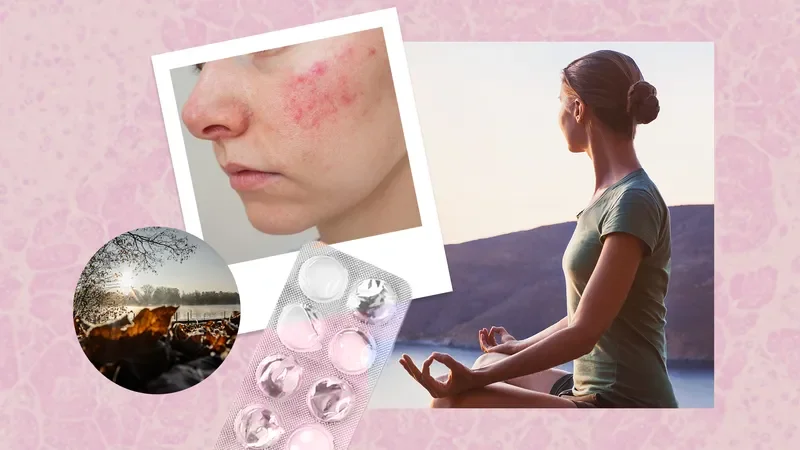7 Psoriasis Triggers Everyone Should Know