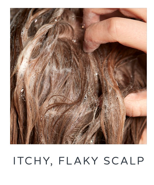 itchy flaky scalp