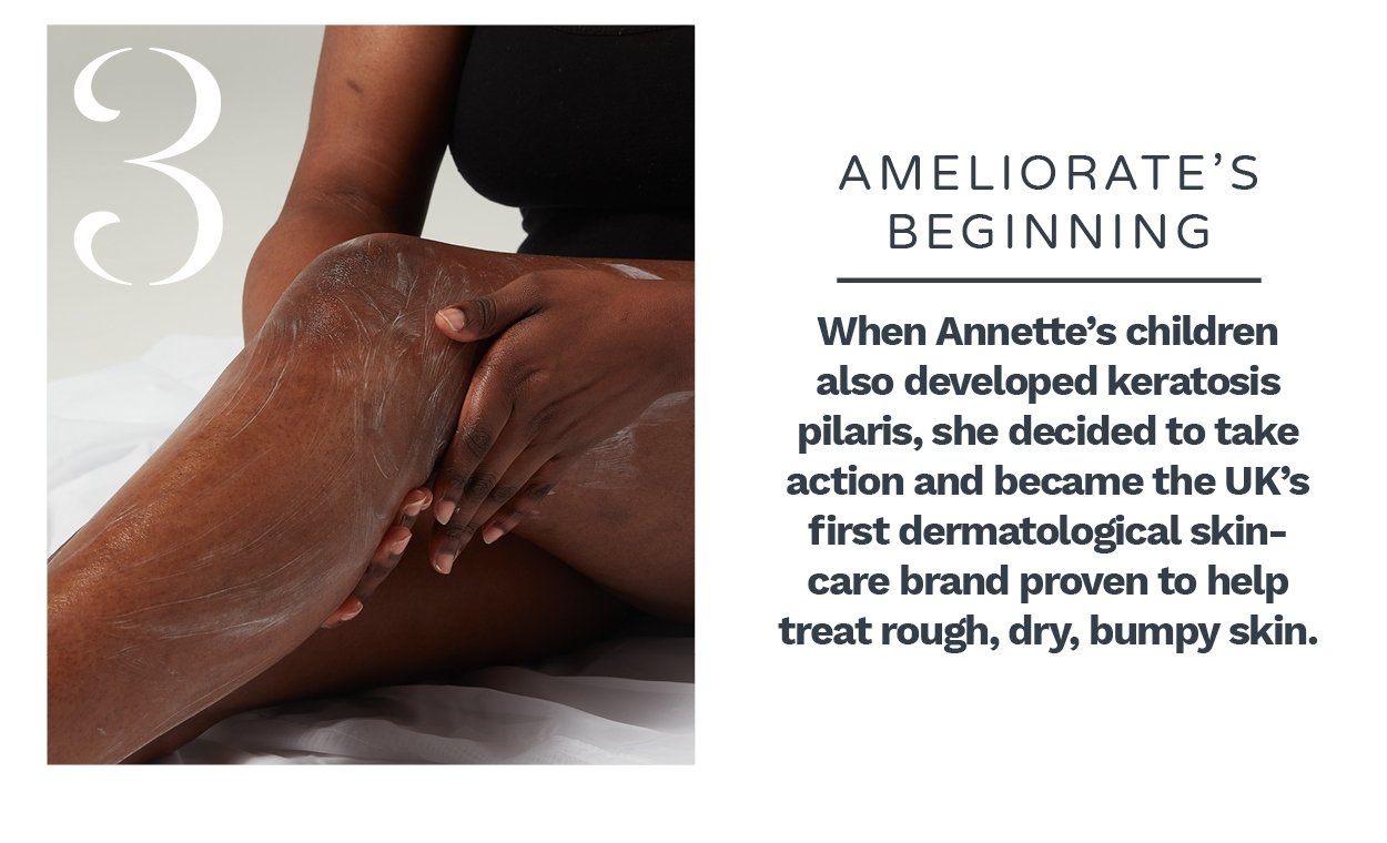 Ameliorate began by developing treatments for Keratosis Pilaris