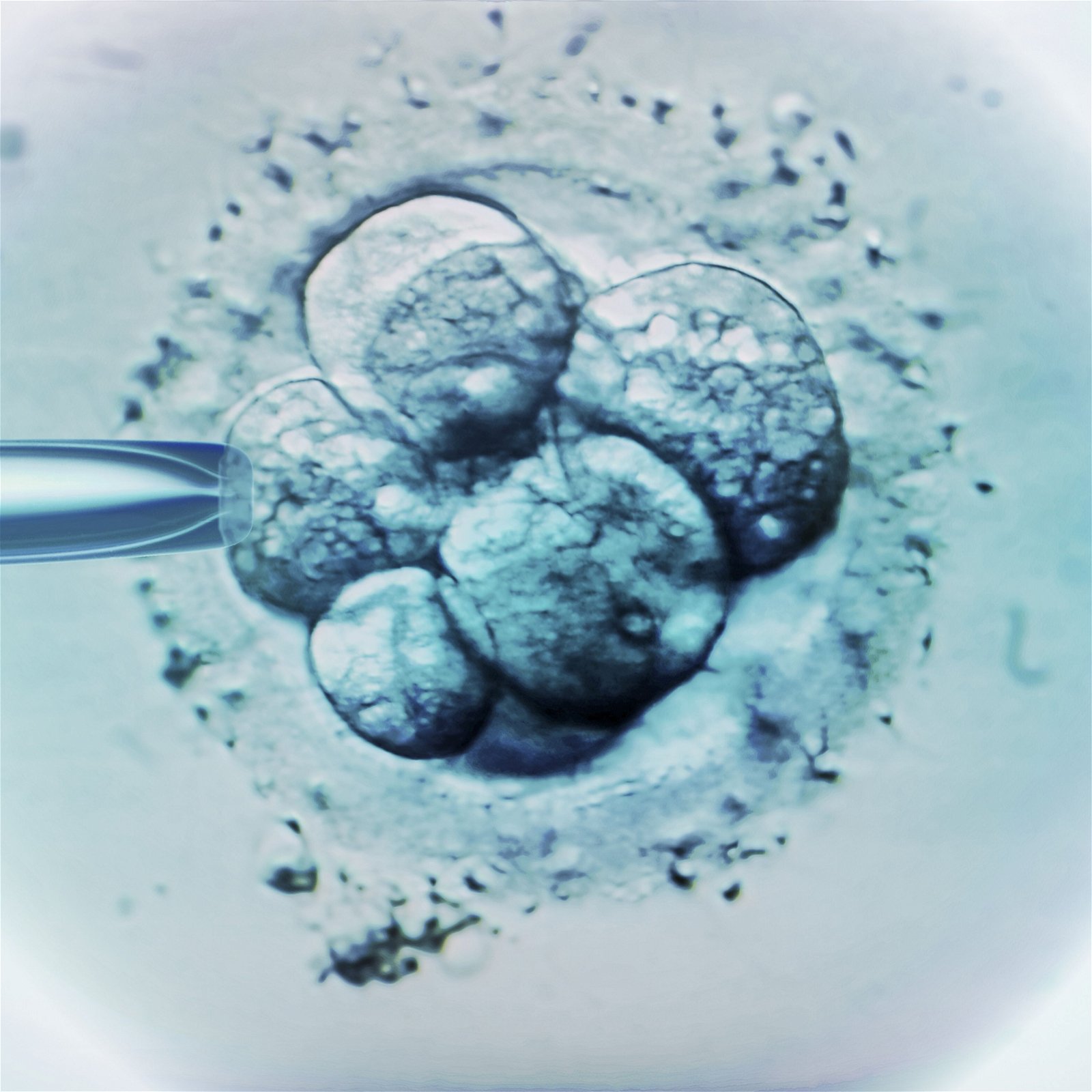 This IVF Ruling Is the Logical End of the Anti-Choice 'Personhood' Scam