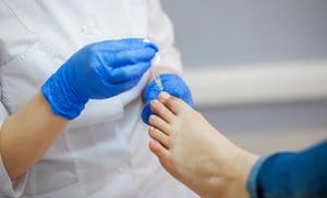 Laser Toe-Fungus Removal