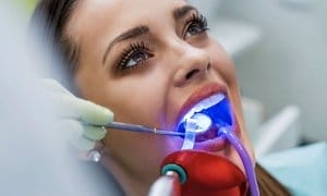 Up to 51% Off Teeth-Whitening Session at 63 Family Dental