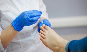 Up to 51% Off on Toe Fungus Treatment at Ankle & Foot Center