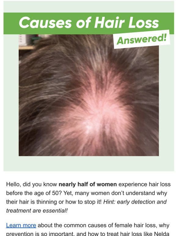 Hair Loss Causes: ANSWERED!