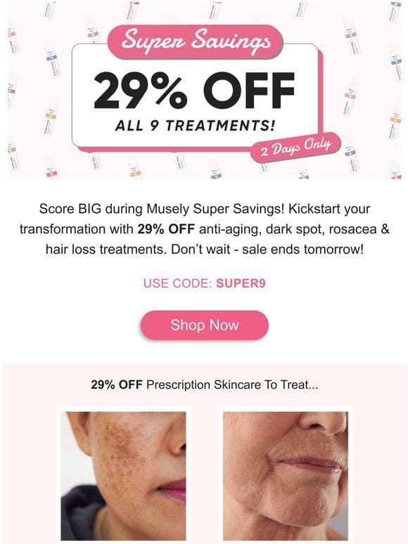 Musely Super Savings: 29% OFF