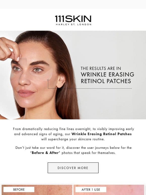 The Results Are In | Wrinkle Erasing Retinol Patches