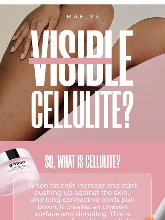 Cellulite? Not on our watch