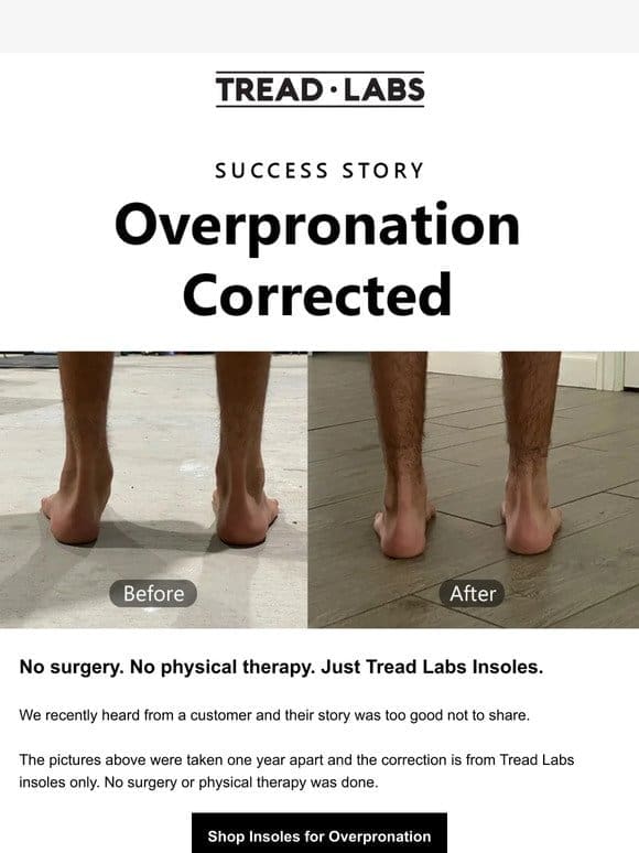 Overpronation Success Story (with Photos)