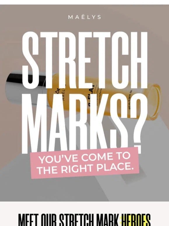 Stretch marks?