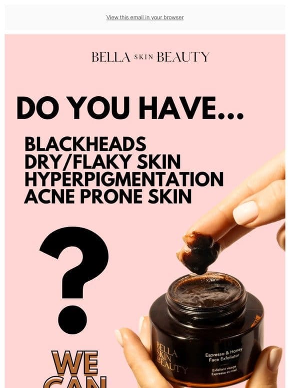How bad are your blackheads? Be Honest!